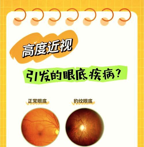 视网膜屏幕的优缺点分析（从画质）