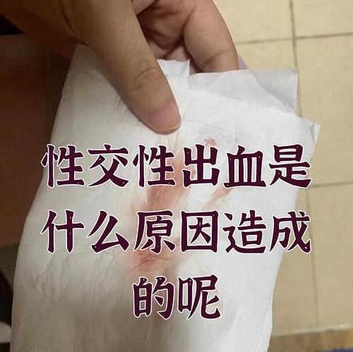 深入了解出血位——解读人体不同出血情况(探究出血位置对人体健康的影响)